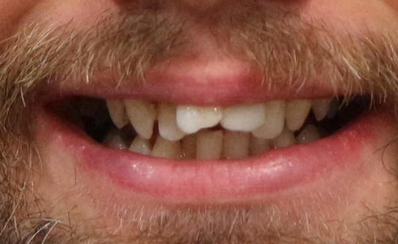 Before