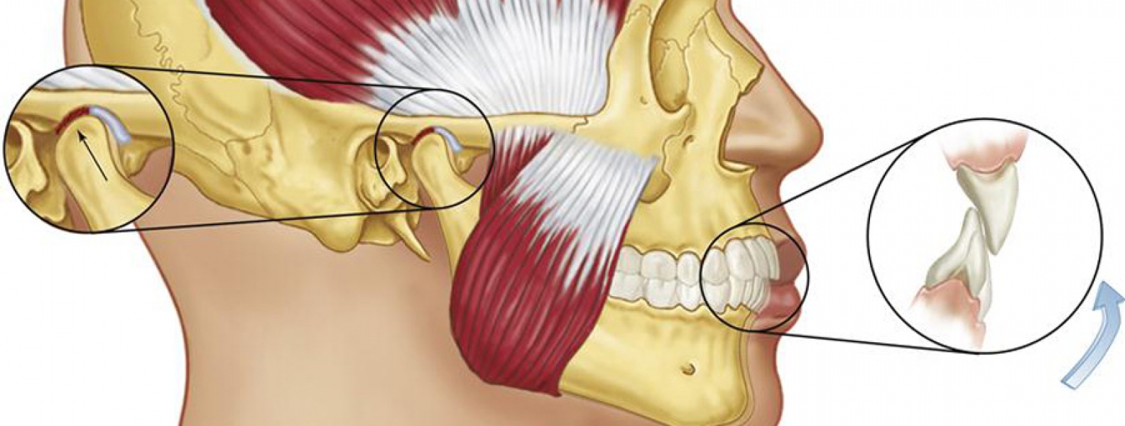 Dysfunkcja narządu żucia – leczenie Bydgoszcz