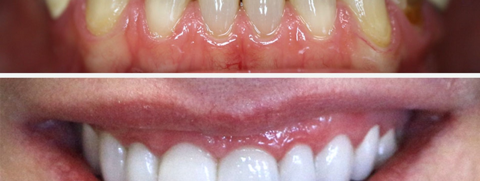 Stomatologia estetyczna Bydgoszcz – metamorfozy