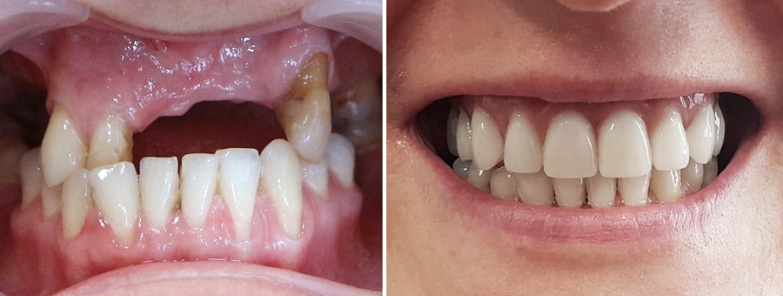 Metamorfozy stomatologiczne – Bydgoszcz szeroko się uśmiecha!