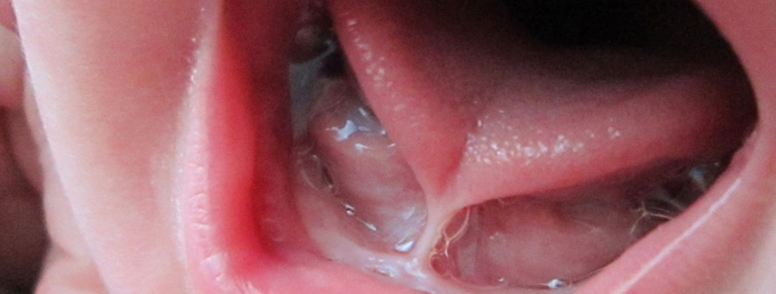 Współpraca ortodonty, fizjoterapeuty i neurologopedy w terapii ortodontycznej